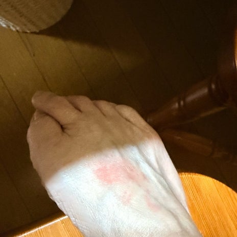 頑固なかかとが柔らかくなる楽しみの画像