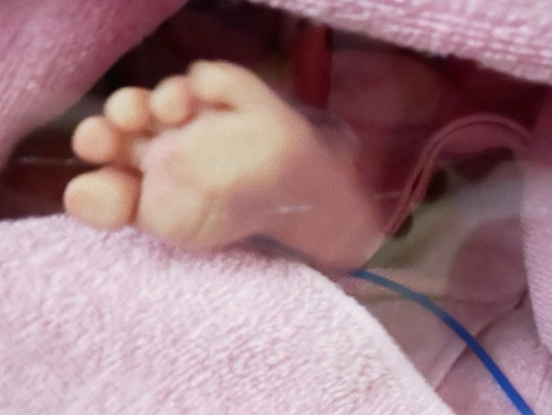 講師から告げられた子の足の現実の画像