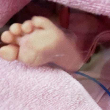 講師から告げられた子の足の現実の画像