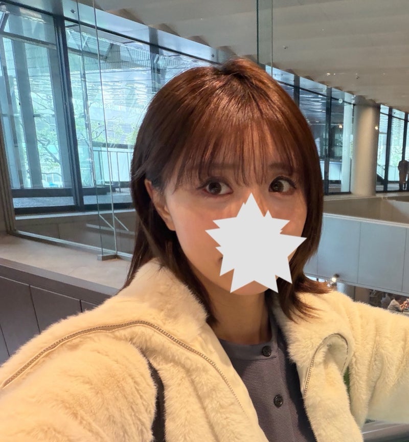 生えている毛が生き返ったAGA治療の画像