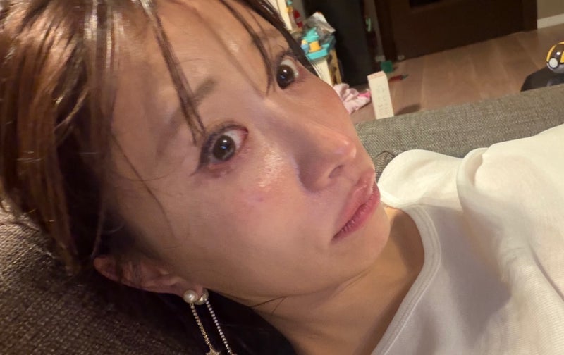 これからの造影剤CTへの恐怖の画像