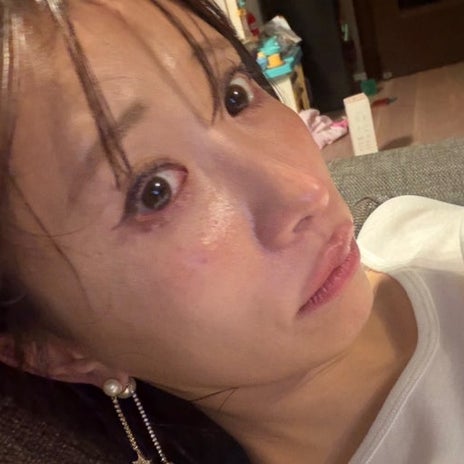 これからの造影剤CTへの恐怖の画像