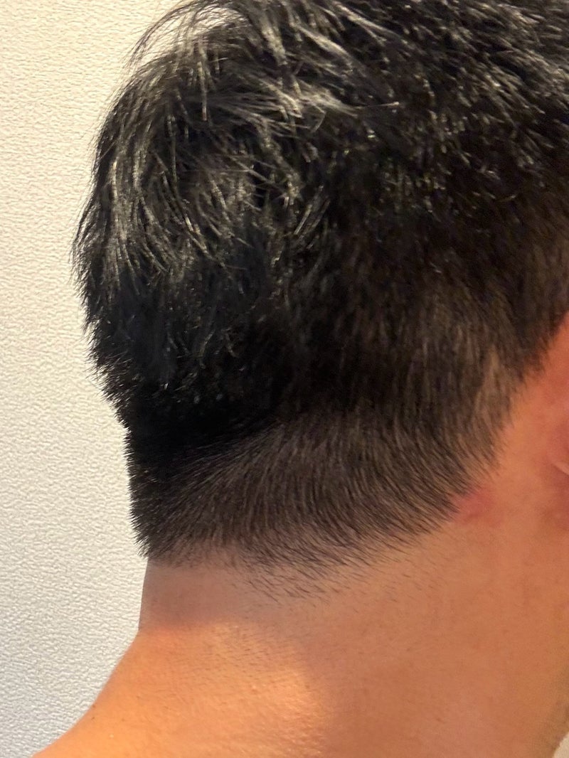 だいたの夫 耳の粉瘤か疑う出来事の画像