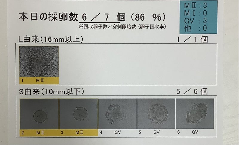 採卵で勝手に判断した培養士への愚痴の画像
