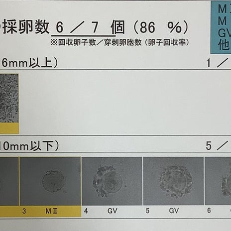 採卵で勝手に判断した培養士への愚痴の画像
