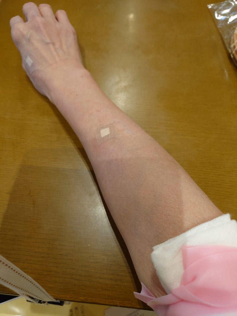 秋野暢子 結局4本も針穴ができた検査の画像