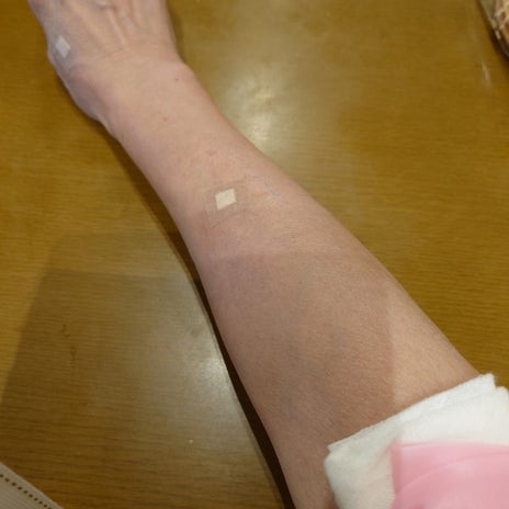 秋野暢子 結局4本も針穴ができた検査の画像