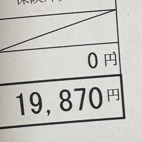 歯医者で400円足りなかった出費の画像