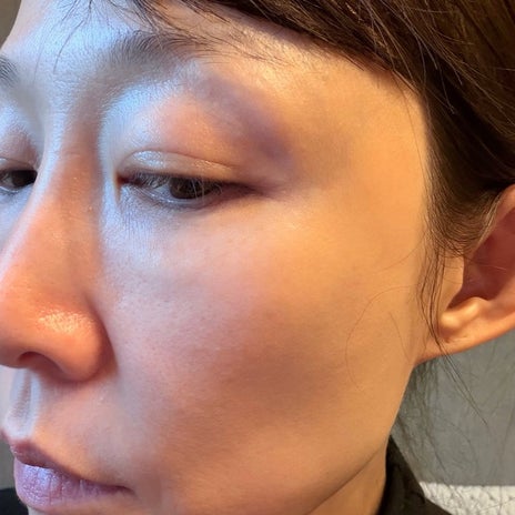 小原正子 人気UVパウダーでの変化の画像