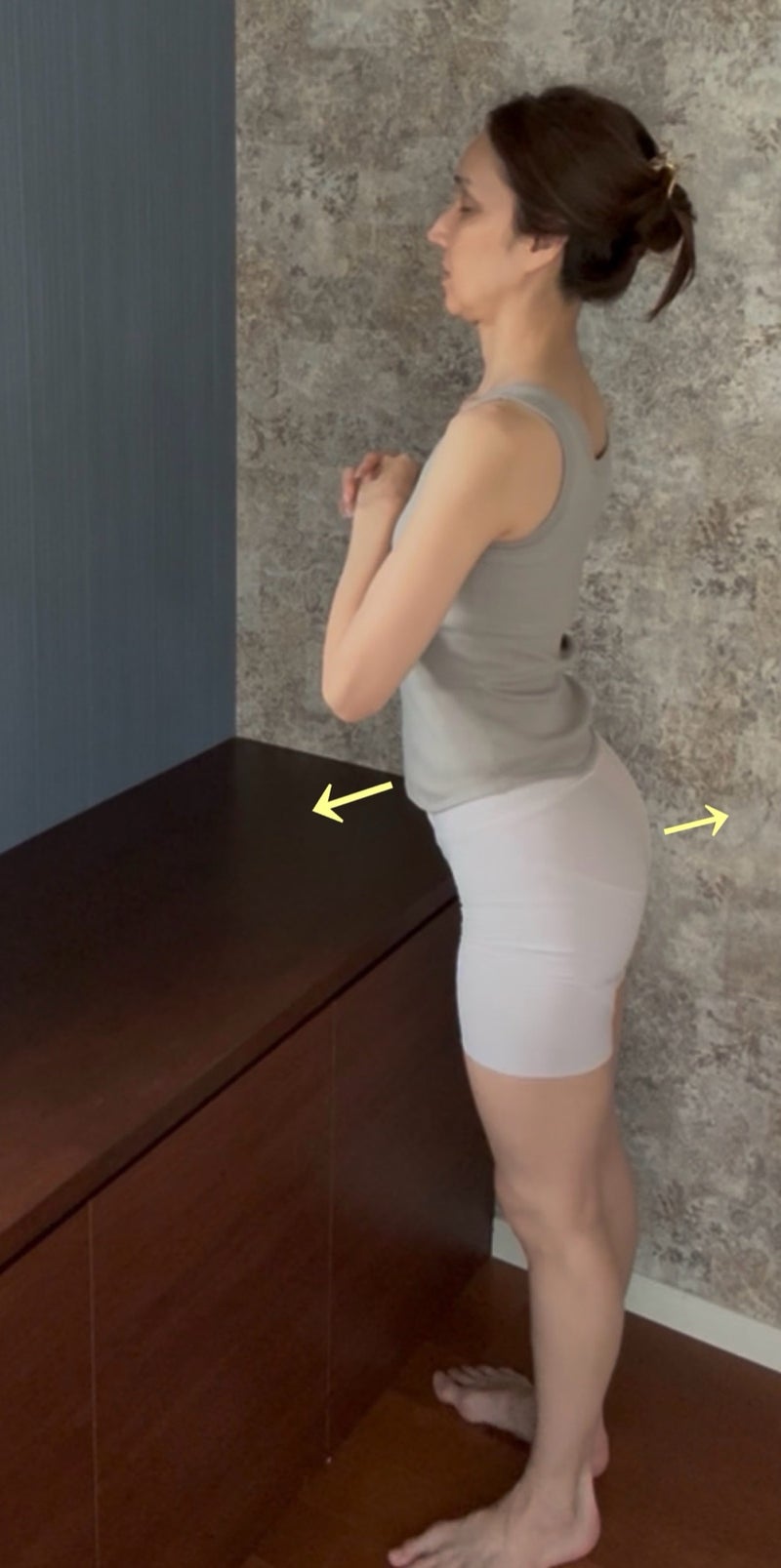 反り腰が原因でたるむフェイスラインの画像