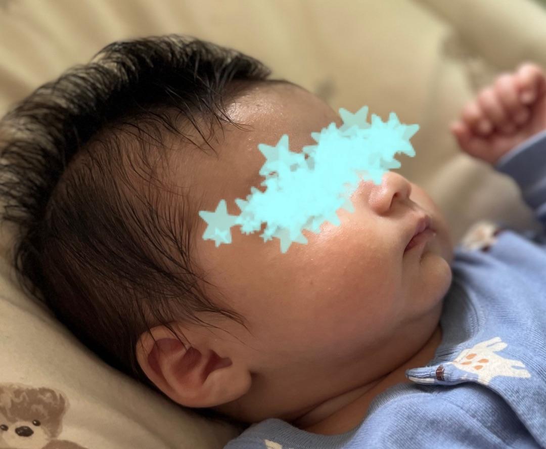 1か月健診時に相談した乳児湿疹の画像