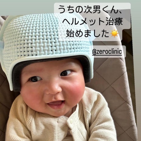 美優 6か月babyがヘルメット治療の画像
