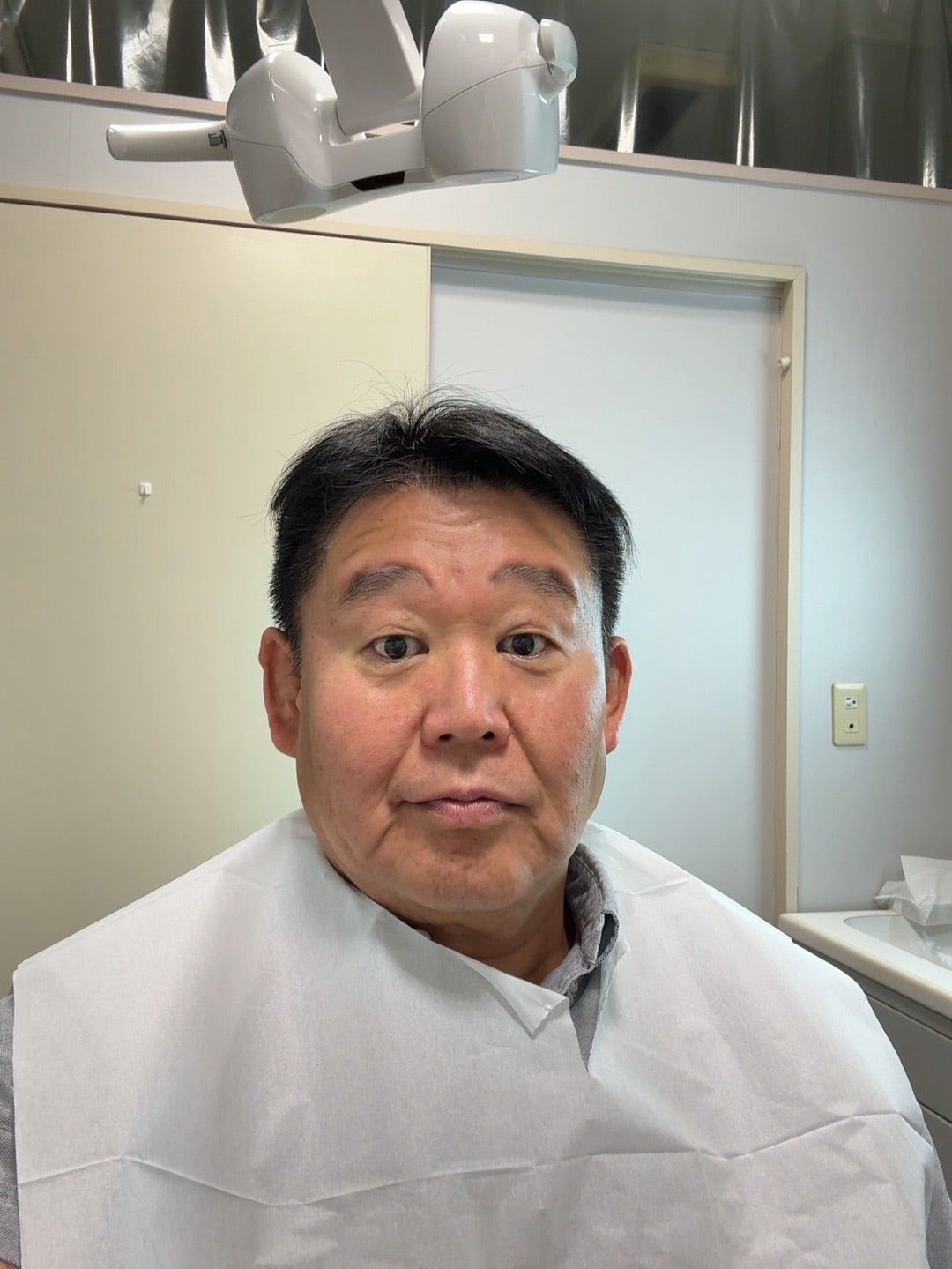 若乃花 やっと入った奥歯の仮歯
