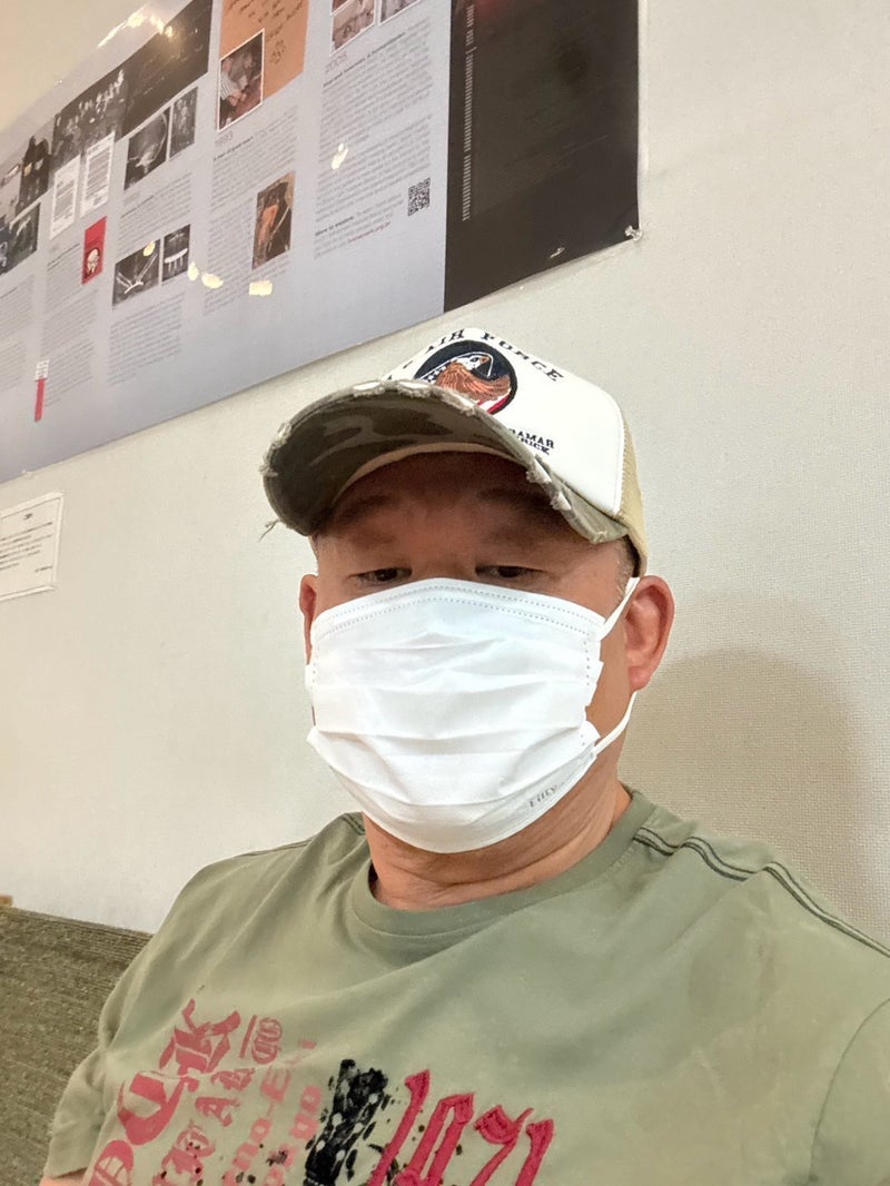 若乃花 次回ラストのインプラント治療の画像