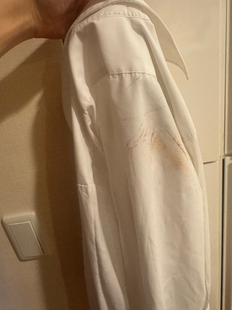 旦那ではなく長女のワイシャツの汚れの画像