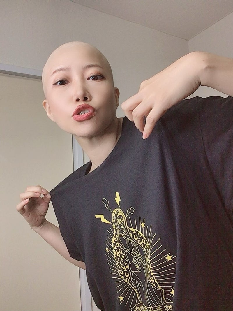 ガンになったと誰に言うか大事な問題の画像