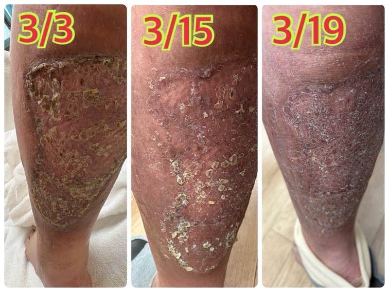 執刀医に傷が汚いと疑われた診察の画像