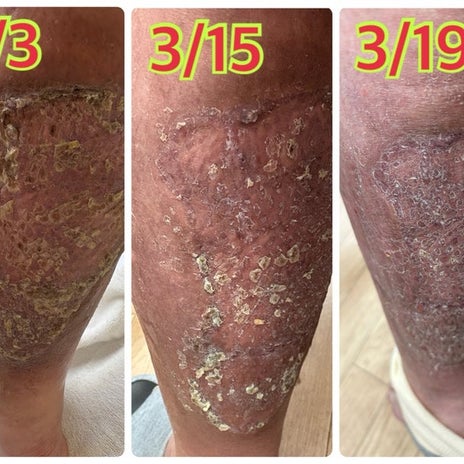 執刀医に傷が汚いと疑われた診察の画像