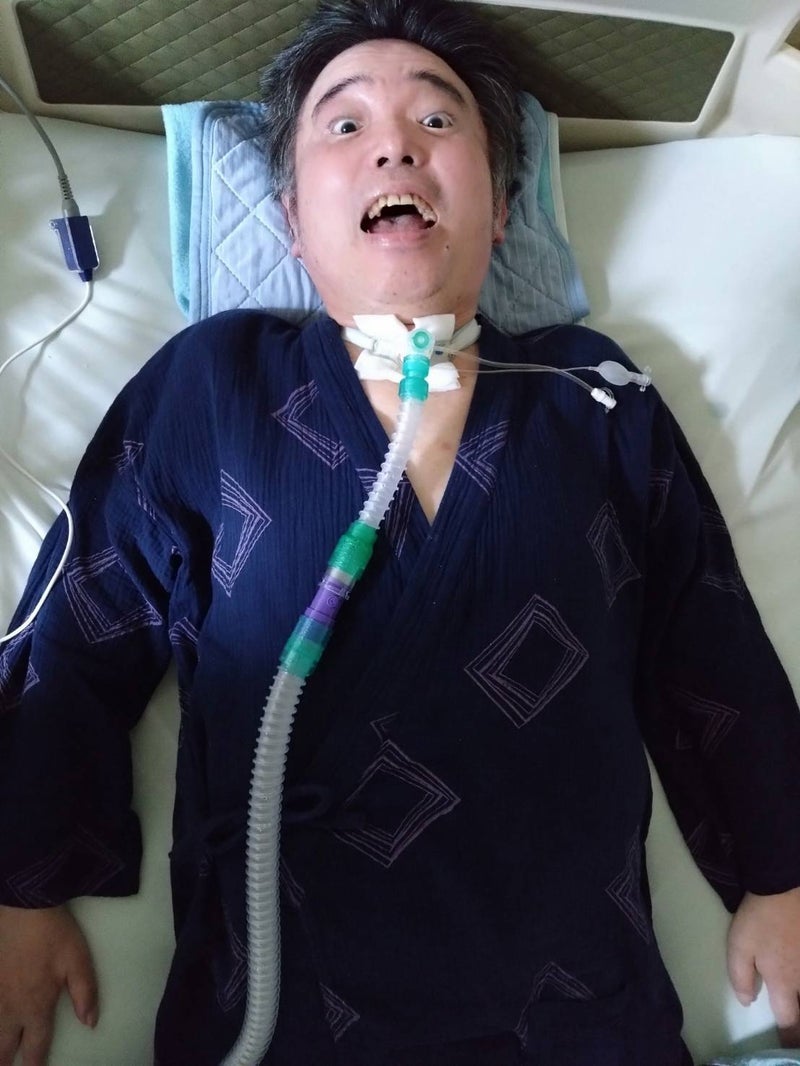 津久井教生 新しくなった呼吸器回路の画像