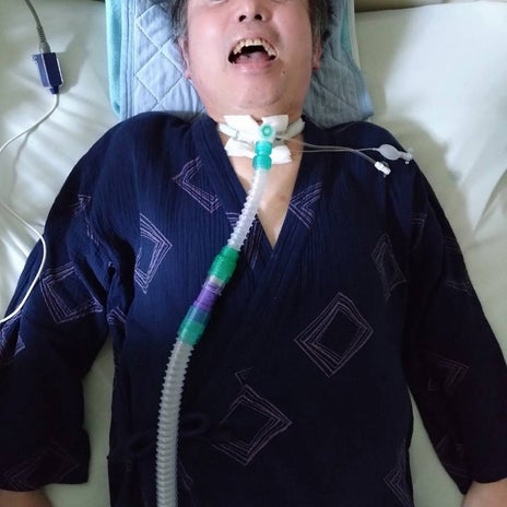 津久井教生 新しくなった呼吸器回路の画像