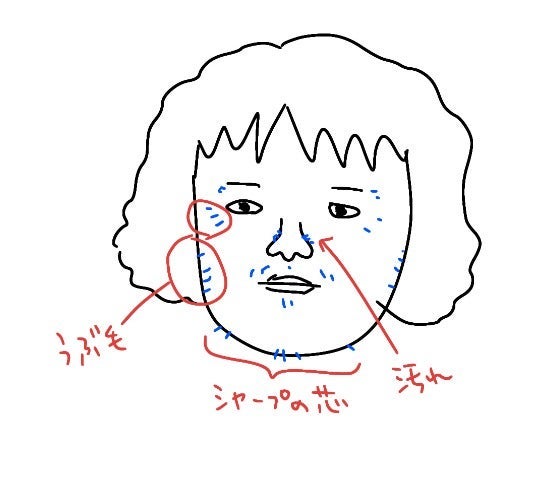 太陽光でびっくりした小鼻の汚れの画像