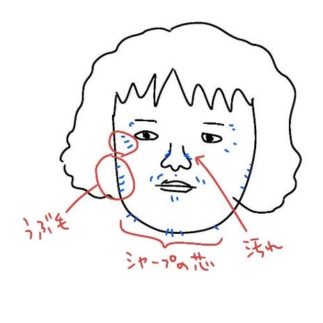 太陽光でびっくりした小鼻の汚れの画像