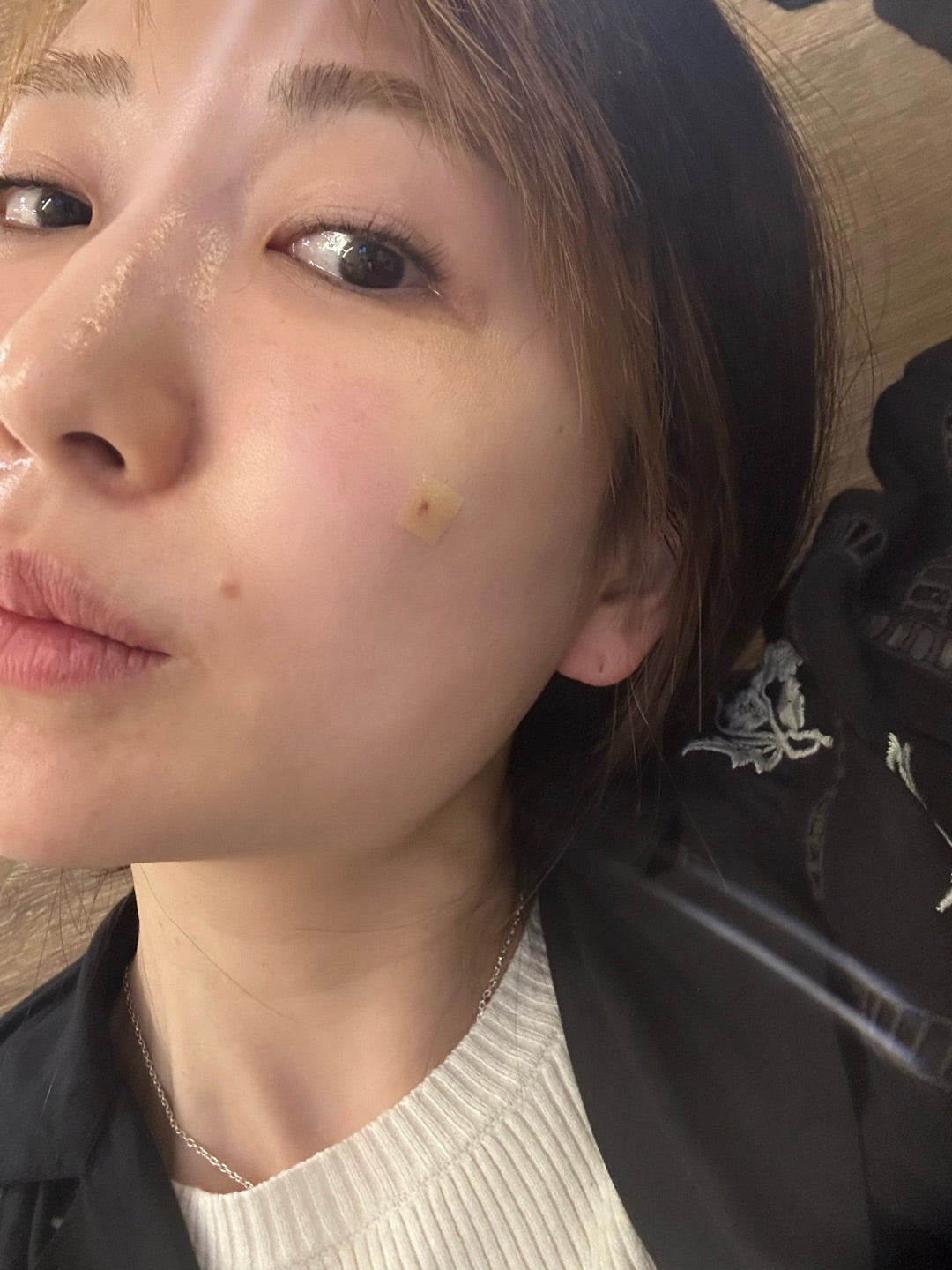 桃 痛かった韓国での美容施術