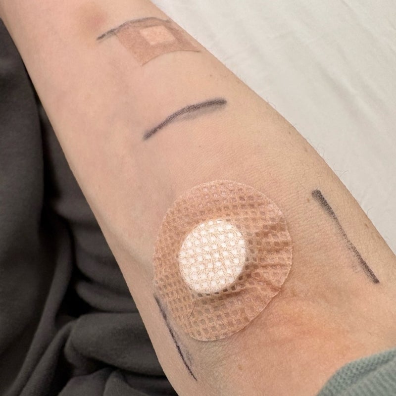 追加で始めた新しい治療の副作用の画像