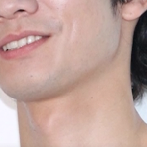 脳出血から6年 33歳人気俳優の今の画像