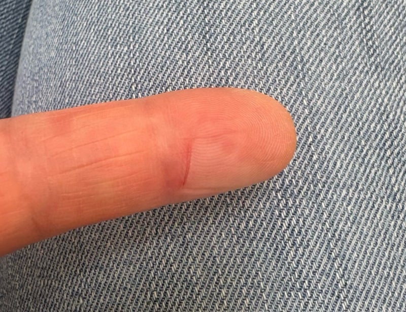 母が研いだ包丁で時間差の怪我の画像