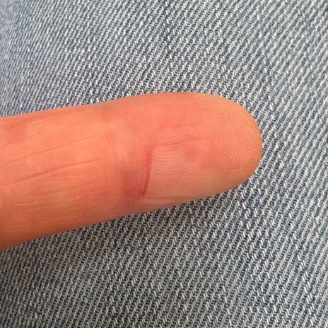 母が研いだ包丁で時間差の怪我の画像