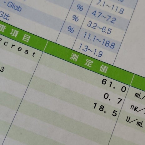 記憶力が衰えた母に疑われた出来事の画像