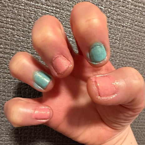 マーブルにした気になるフットネイルの画像