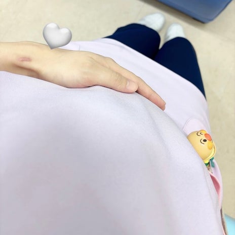 子育てで腱鞘炎になり手術した跡の画像