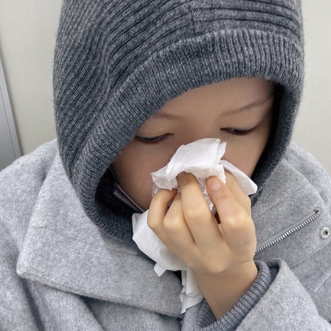 中々止まらず耳鼻科で焼いた鼻血の画像