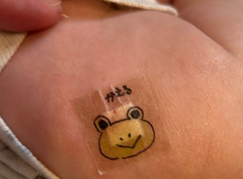 原因不明の発疹でドクターストップの画像