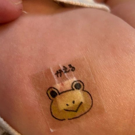 原因不明の発疹でドクターストップの画像