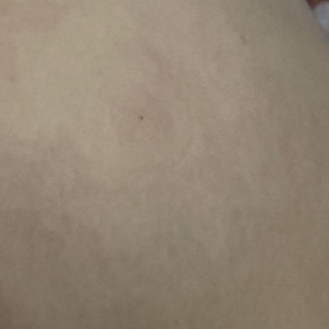 朝起きられなかった新薬の副作用の画像