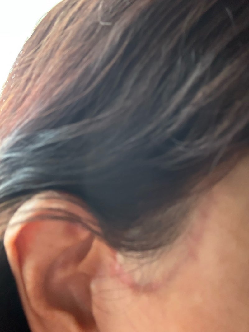 思ったより効果のなかった美容手術の画像