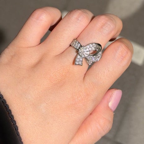 ストレスで中指につけている婚約指輪の画像