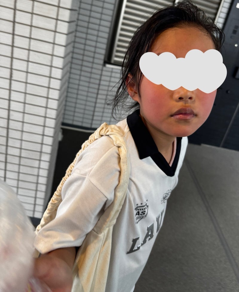 5月なのに顔が真っ赤になった娘の画像