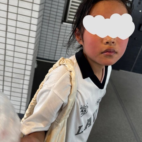 5月なのに顔が真っ赤になった娘の画像