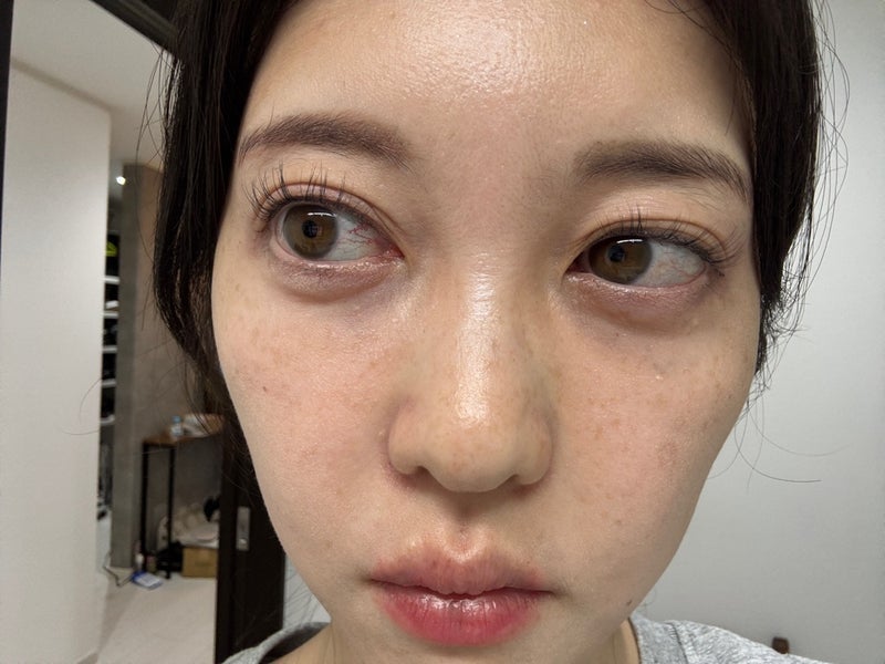 ぷちあや 42歳でアイプチ再開の画像