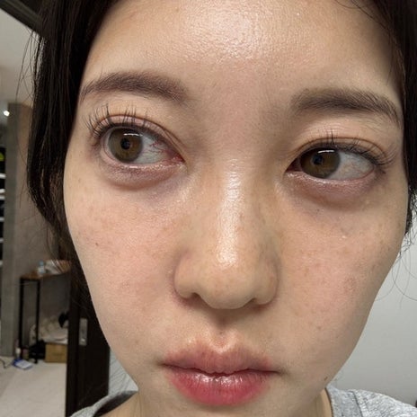 ぷちあや 42歳でアイプチ再開の画像