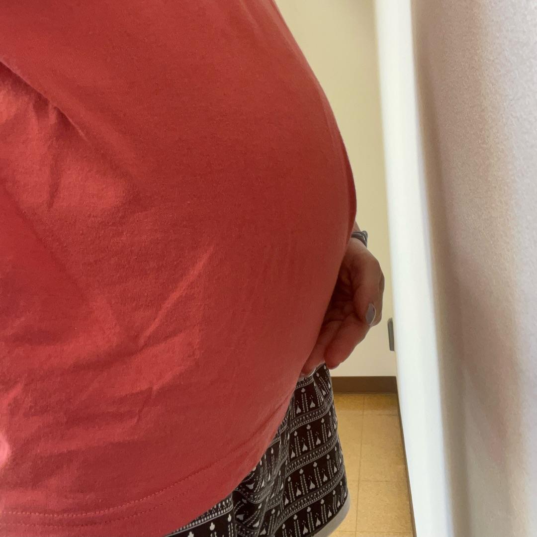 喘息等で張った妊娠8か月のお腹の画像