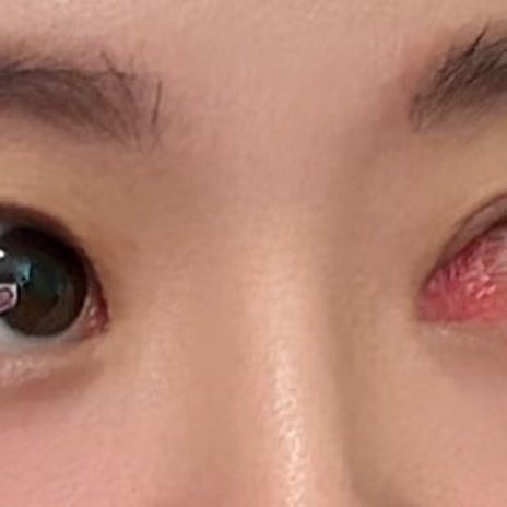 先生から教わった目やにの別の言葉の画像