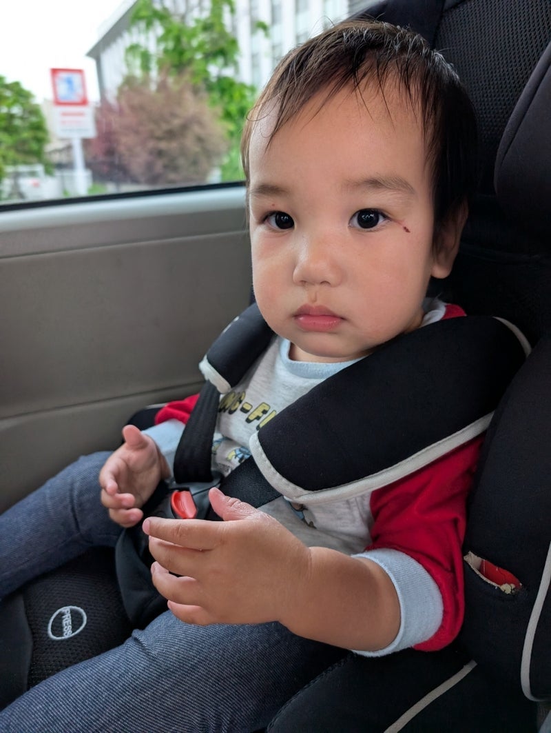 チェリー 息子が痛がり整形外科