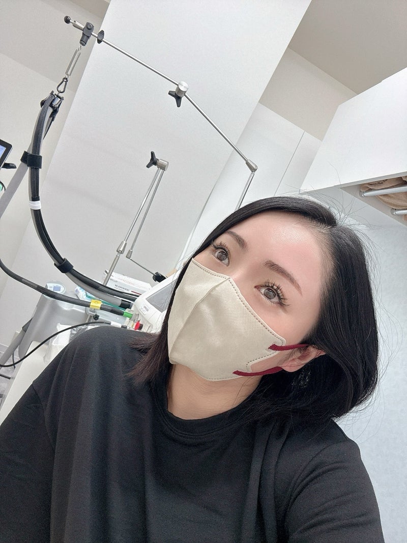 ちょっと痛かった顔の産毛脱毛
