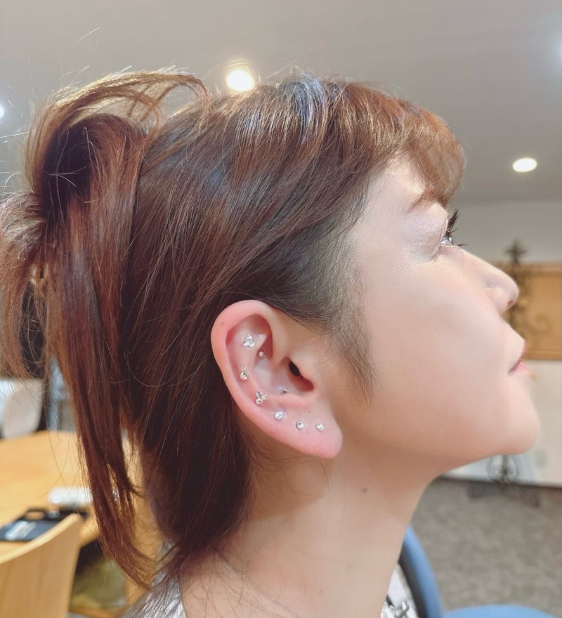 人生初の耳ツボで実感したリフトアップの画像