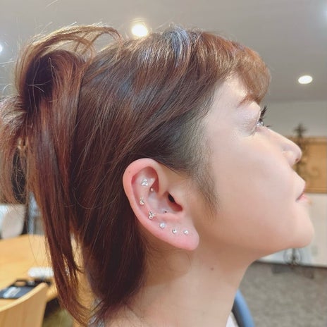 人生初の耳ツボで実感したリフトアップの画像